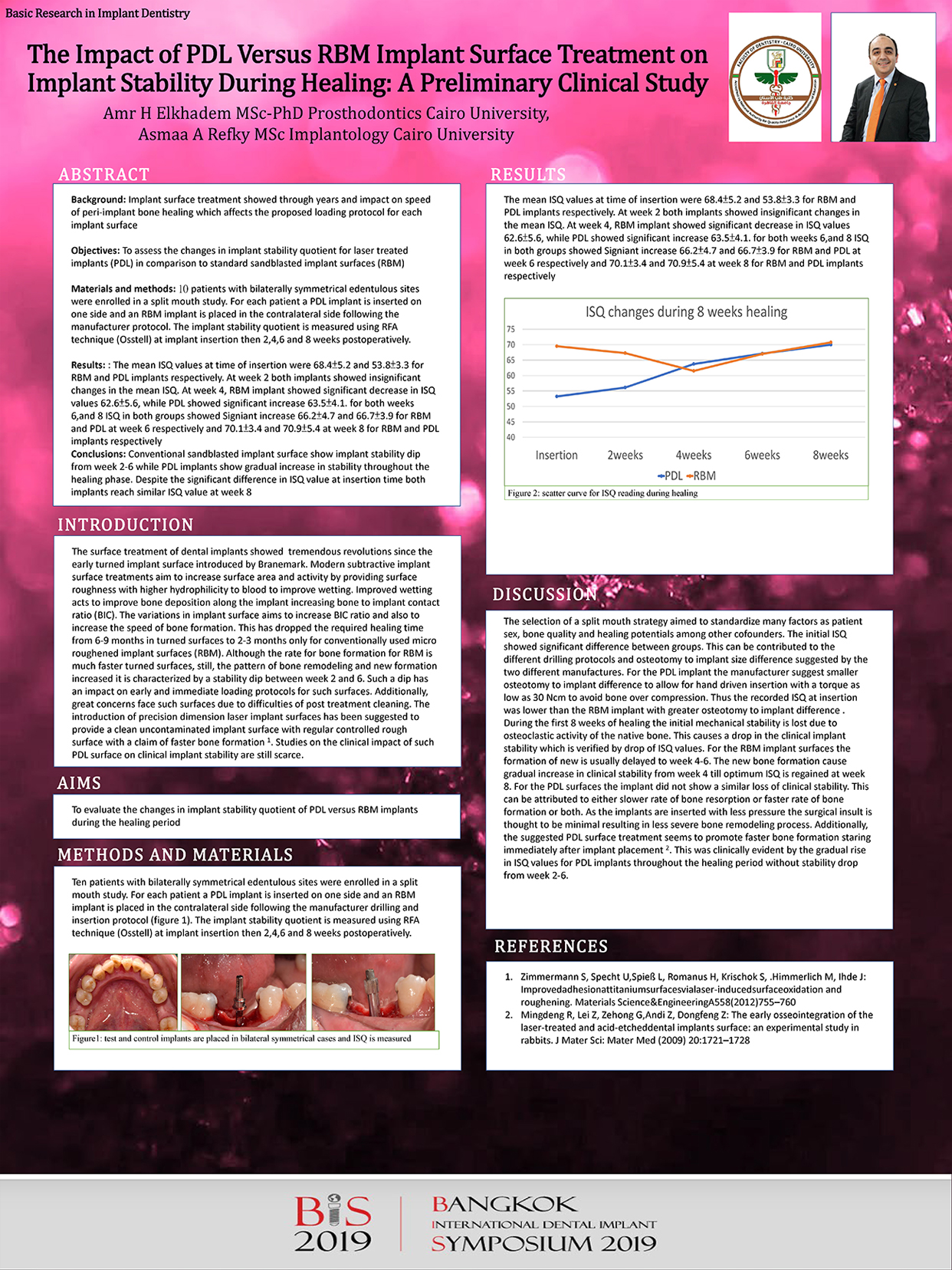 The Impact of PDL Versus RBM Implant Surface Treatment on Implant Stability During Healing: A Preliminary Clinical Study