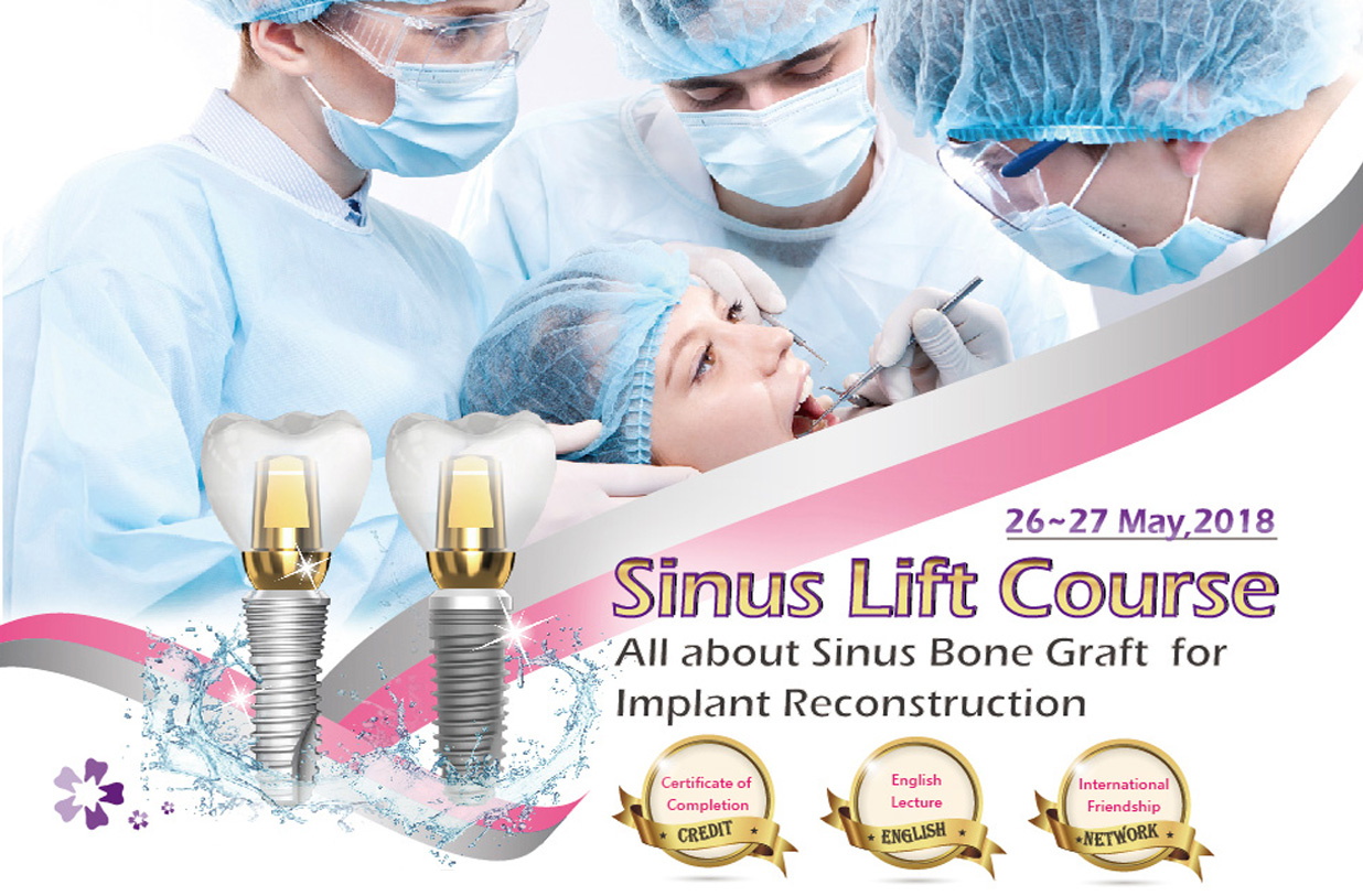 All about Sinus Bone Graft for Implant Reconstruction 2018