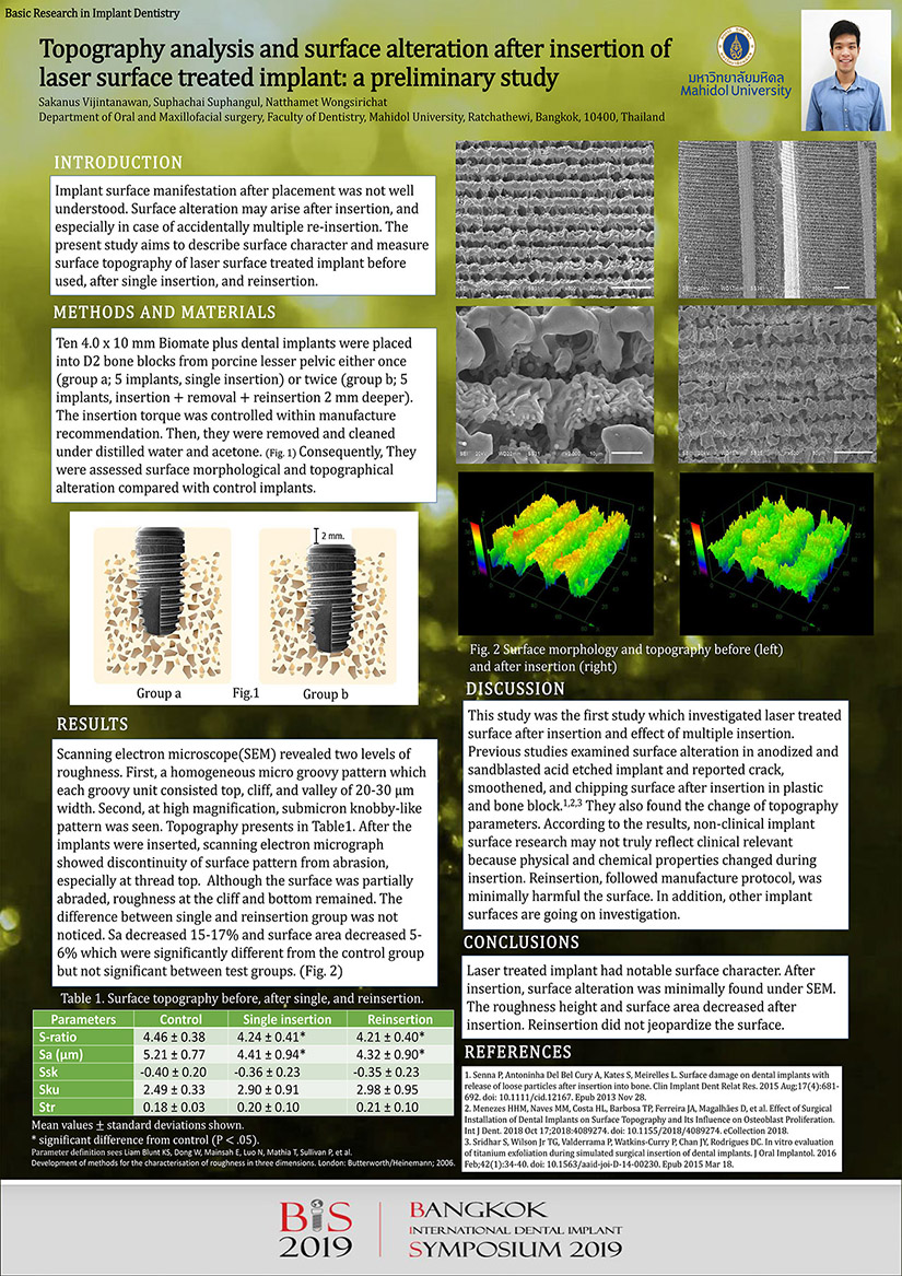 Topography analysis and surface alteration after insertion of laser surface treated implant: a preliminary study